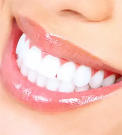 A bright smile after professional teeth whitening